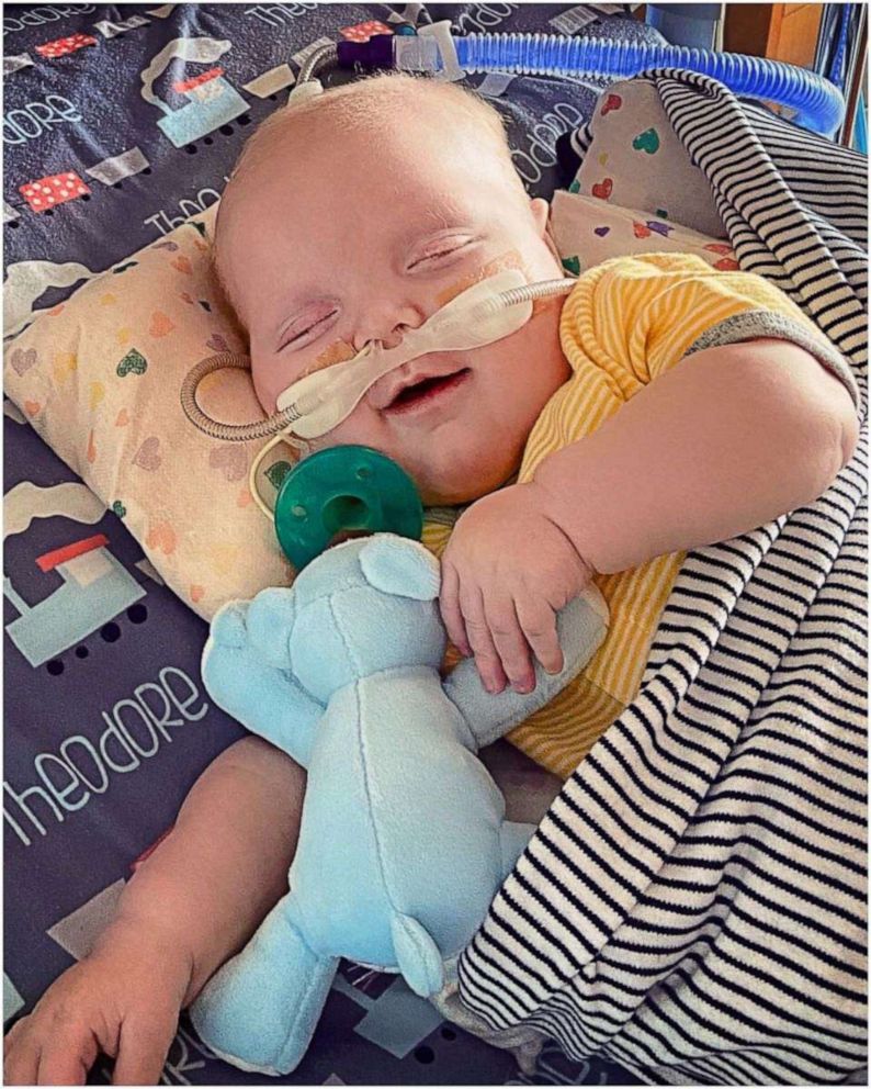 PHOTO: Theodore "Teddy" Nelson has spent 185 days in the hospital. On Nov. 13, the 6-month-old had his second open heart surgery and on Feb. 6, Teddy finally smirked for his mom and dad.