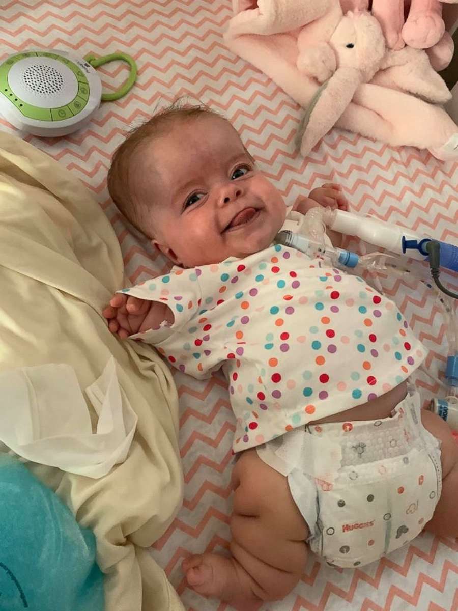 PHOTO: Paisley Courson was born with a severe skeletal disorder called thanatophoric dysplasia (TD). Her parents Melissa and Chris of Douglasville, Georgia, learned of the diagnosis when Melissa was 20 weeks pregnant.