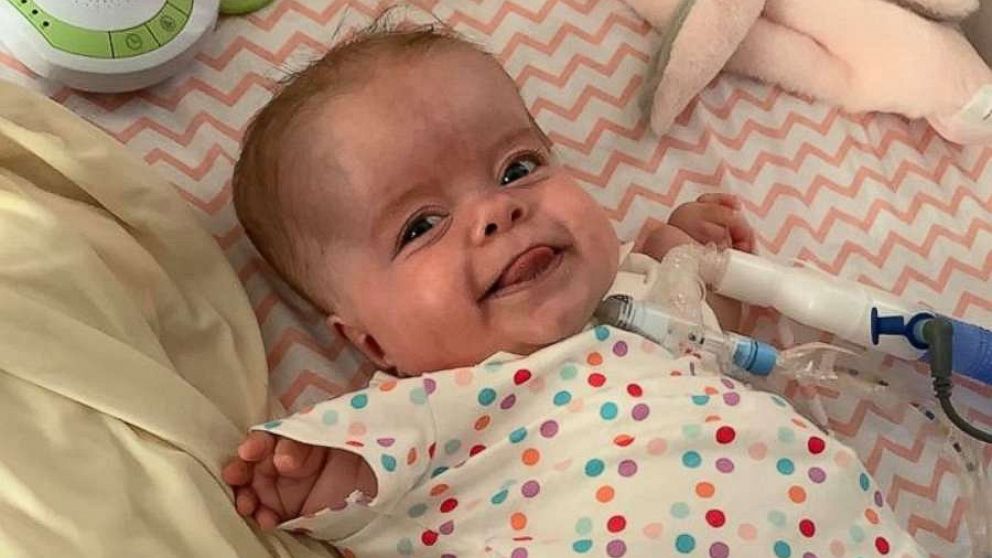 PHOTO: Paisley Courson was born with a severe skeletal disorder called thanatophoric dysplasia (TD). Her parents Melissa and Chris of Douglasville, Georgia, learned of the diagnosis when Melissa was 20 weeks pregnant.