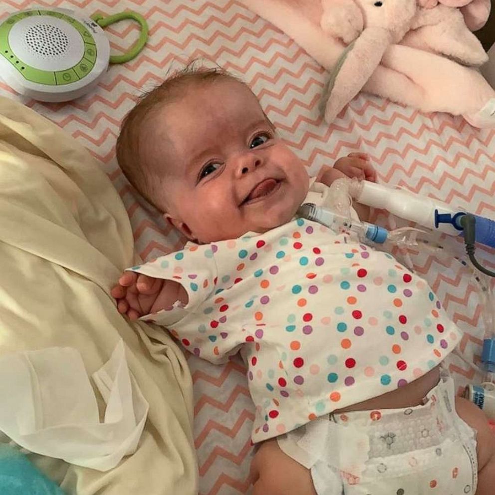 VIDEO: Baby with rare dwarfism home after 184 days in hospital 