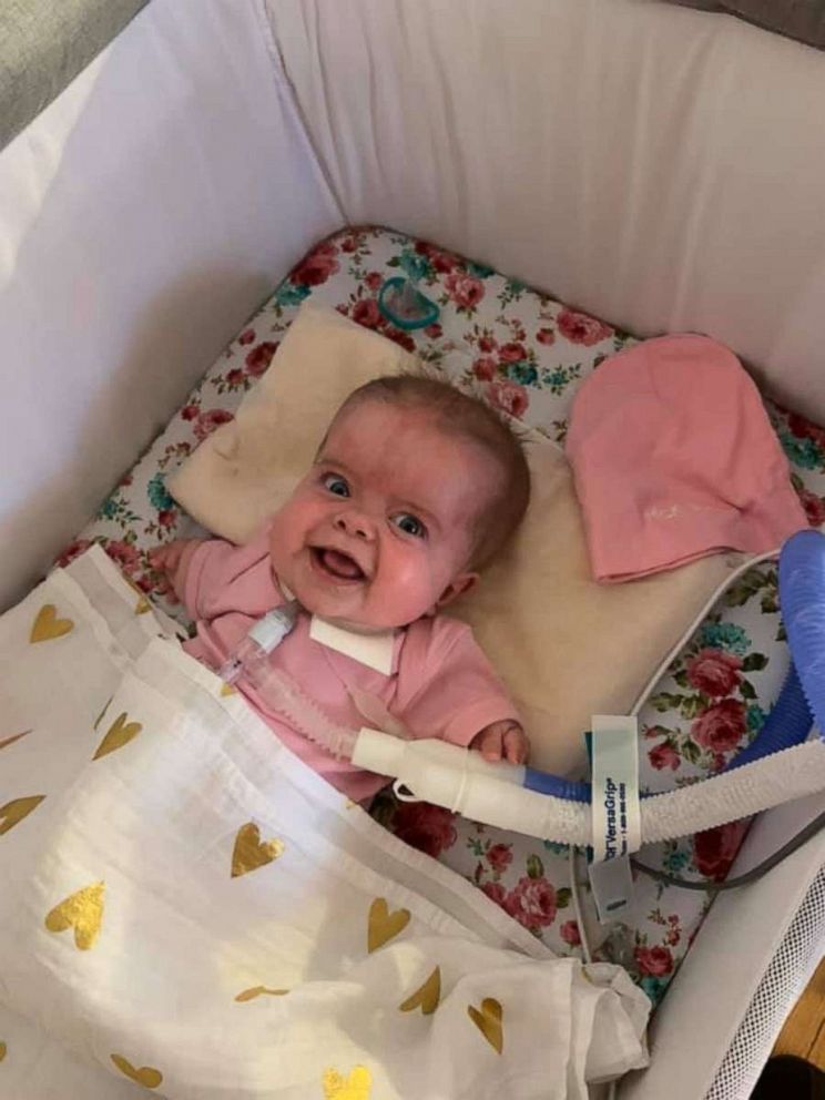 PHOTO: Paisley Courson was born with a severe skeletal disorder called thanatophoric dysplasia (TD). Her parents Melissa and Chris of Douglasville, Georgia, learned of the diagnosis when Melissa was 20 weeks pregnant.