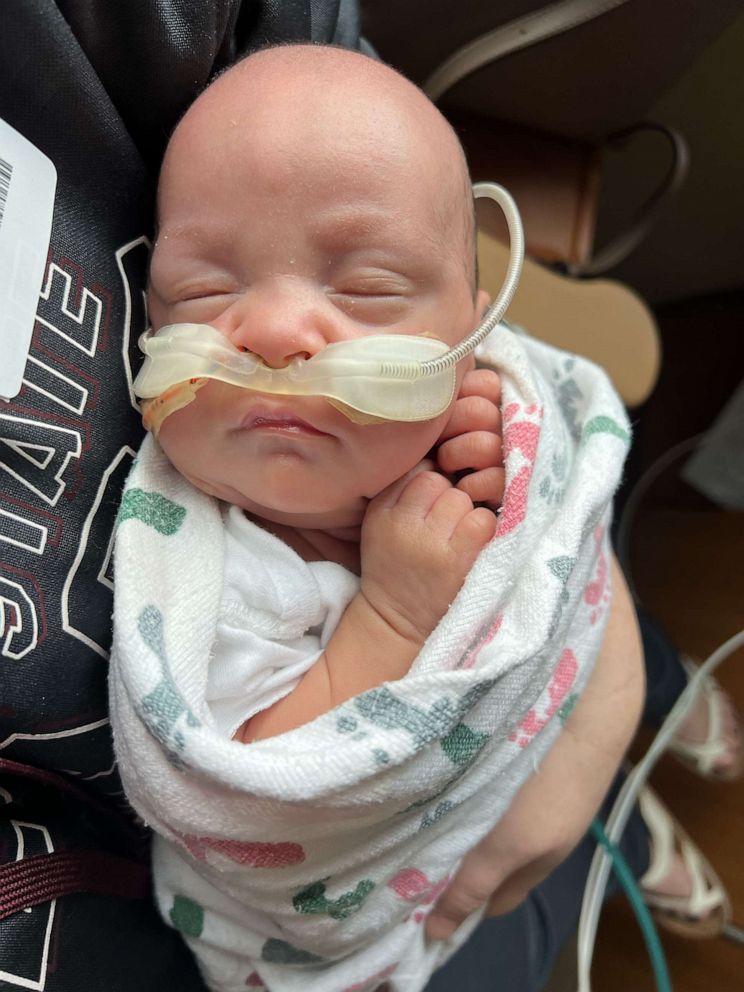 PHOTO: Baby Remington was born 22 weeks early on Oct. 10, 2022.