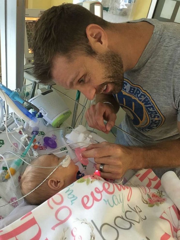 PHOTO: Matt Backe looks at his daughter, Everly, who was born with a congenital heart defect.