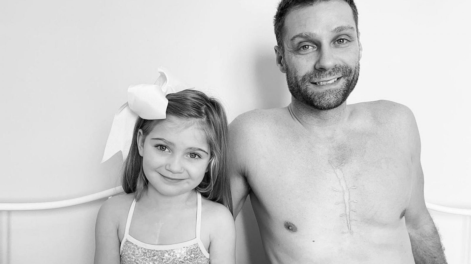 PHOTO: Matt Backe got a tattoo to match the open heart surgery scar of his 4-year-old daughter, Everly.