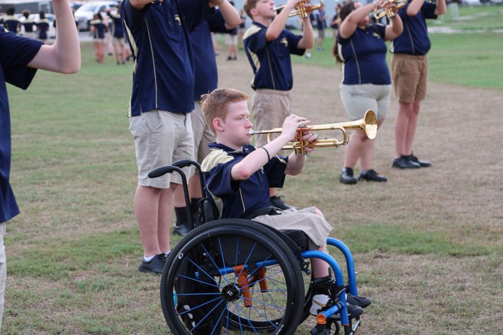 PHOTO: Casey, 16, says he loves to play the trumpet, which he's played since the seventh grade.