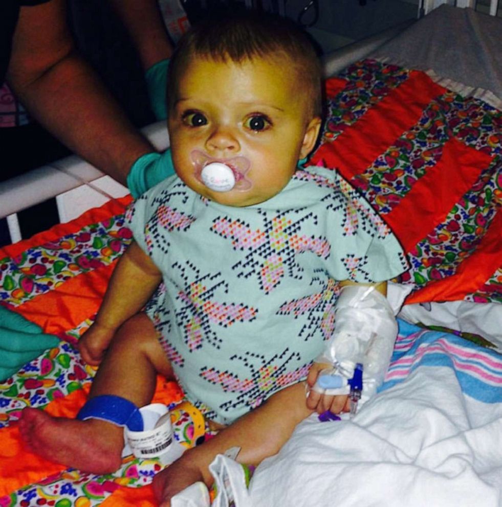 PHOTO: Beatrice Weidner was born with a rare liver disease and was given a liver transplant at 6 months old at the Cincinnati children's hospital.