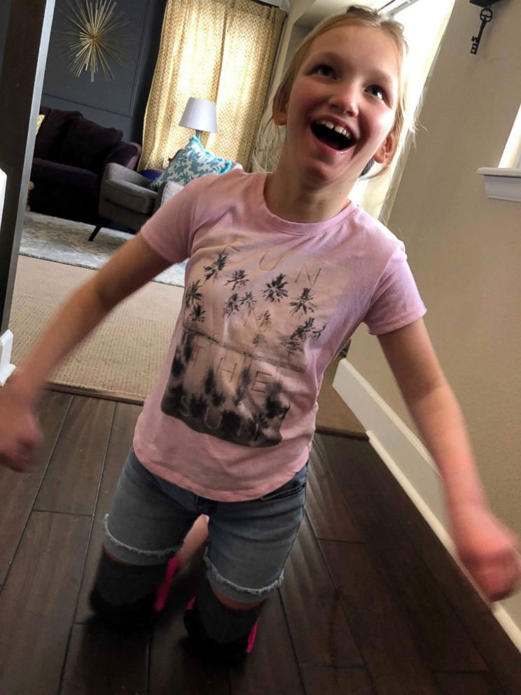 PHOTO: Birkley, 11, has cerebral palsy and spent most of her life walking on her knees but recently took her first steps in a now-viral video.