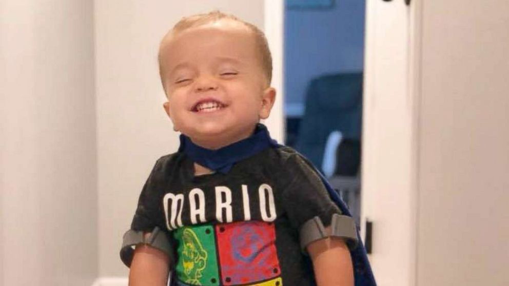 PHOTO: Roman Dinkel, 2, has gained millions of followers from around the world after a video of him walking went viral.