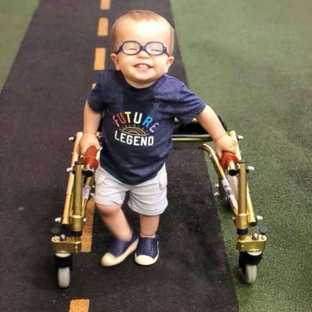 can babies born with spina bifida walk