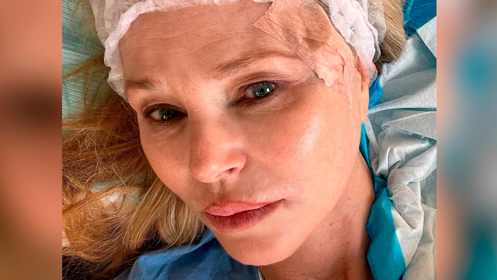 PHOTO: Christie Brinkley shared she was diagnosed with skin cancer and recently underwent surgery.