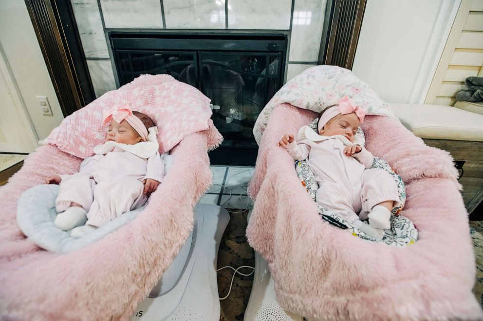 PHOTO: Lydia and Lynlee are monoamniotic-monochorionic identical twins, meaning they shared the same placenta and amniotic sac.
