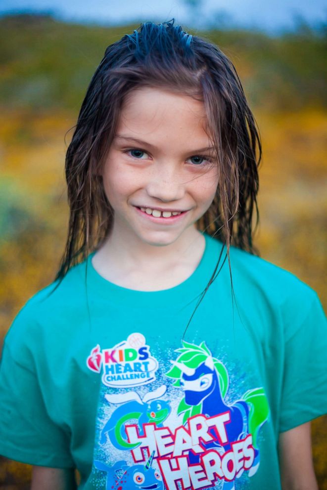 PHOTO: Brodie Southgate, 9, chopped 15 inches of his own hair and gave it to gave it to the organization, Children With Hair Loss. 