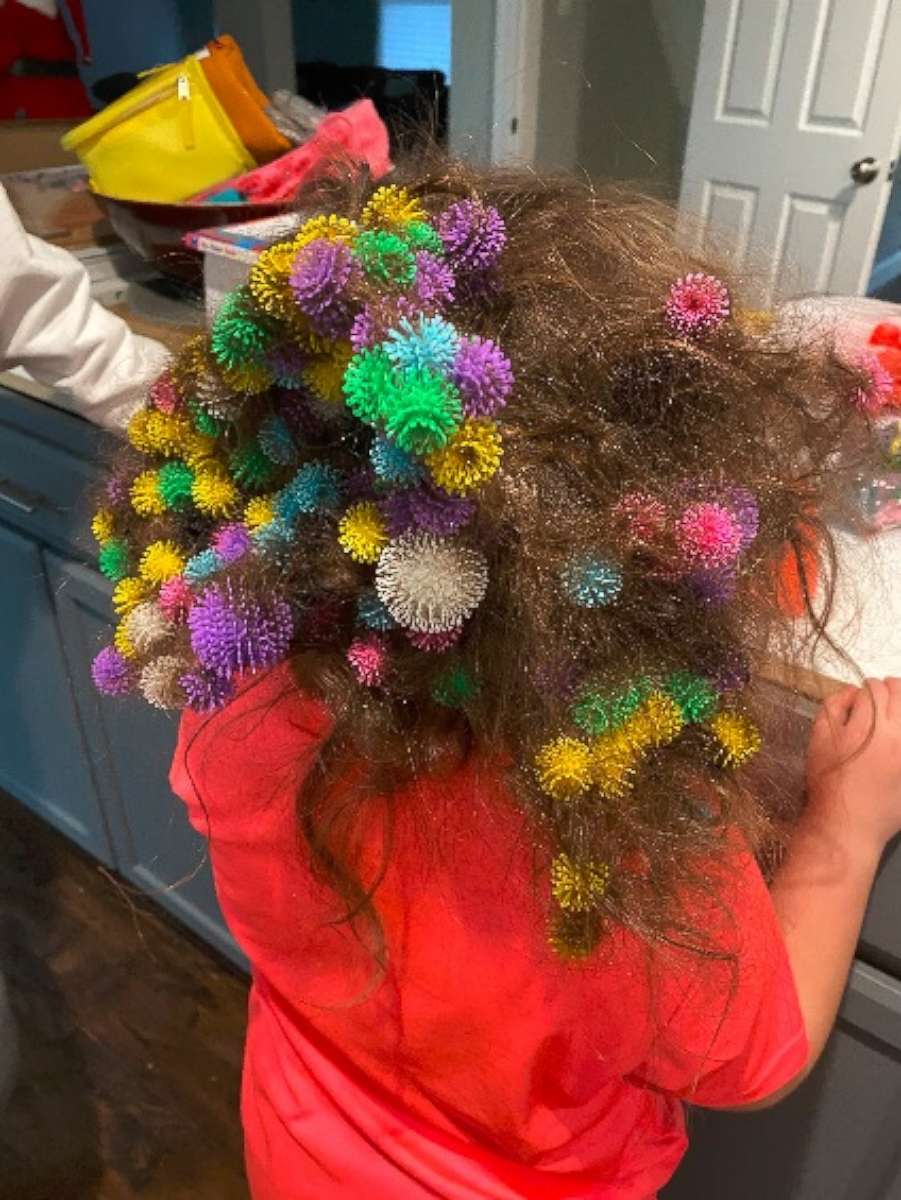 Mom warns parents after child gets 150 'Bunchems' stuck in hair - ABC News