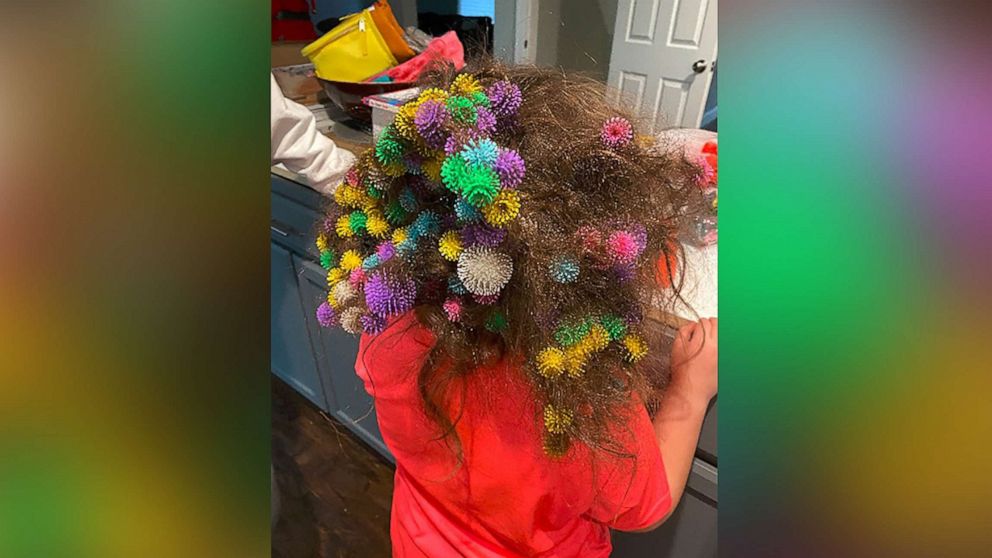 PHOTO: Lisa Hoelzle of Churchville, Pa., said it took roughly 20 hours to remove toys called Bunchems from her 7-year-old daughter Abigail's hair on Jan. 8, 2021.