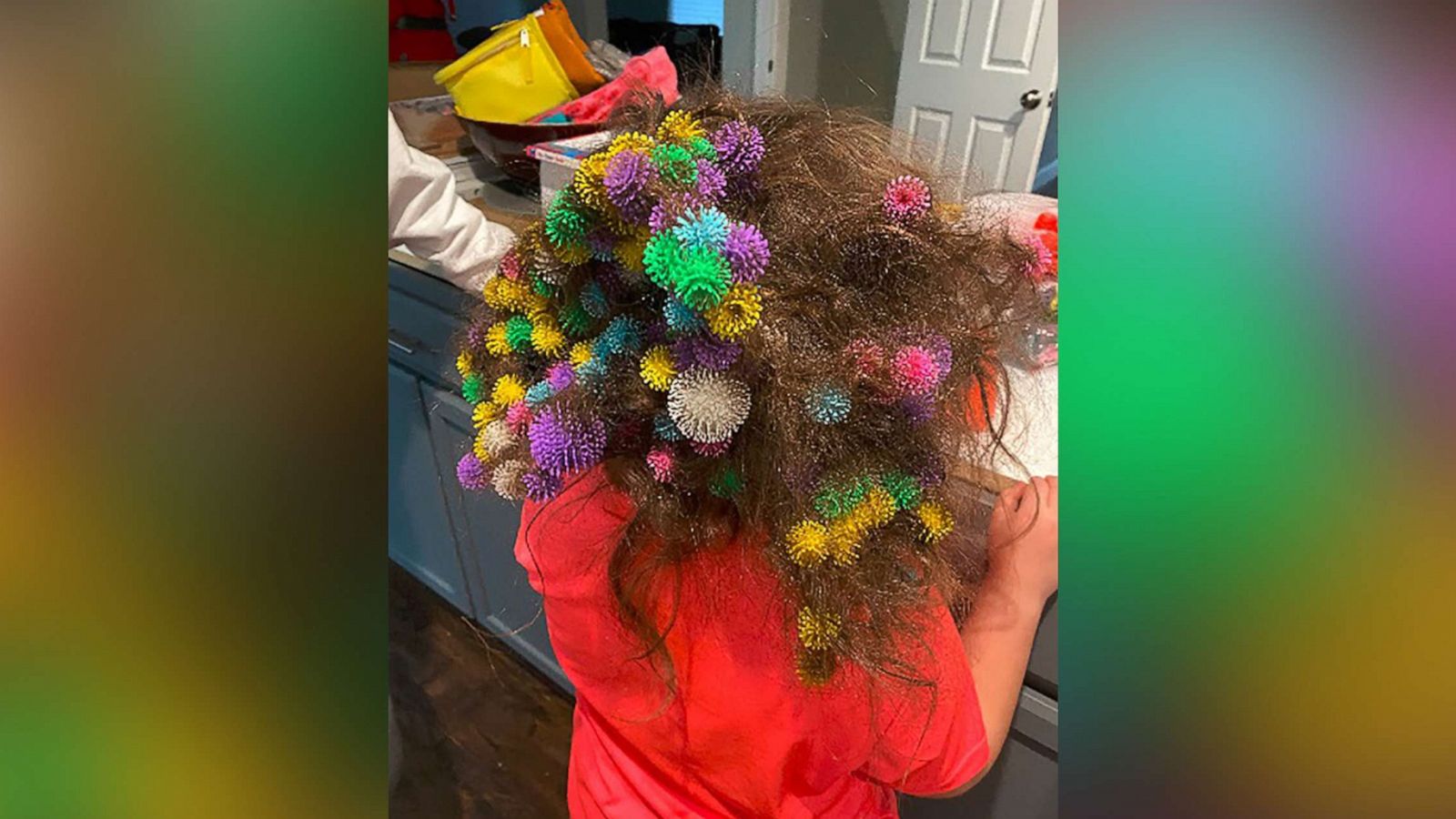 PHOTO: Lisa Hoelzle of Churchville, Pa., said it took roughly 20 hours to remove toys called Bunchems from her 7-year-old daughter Abigail's hair on Jan. 8, 2021.