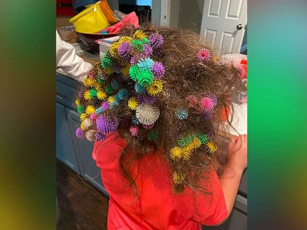 Mom warns parents after child gets 150 'Bunchems' stuck in hair - Good  Morning America