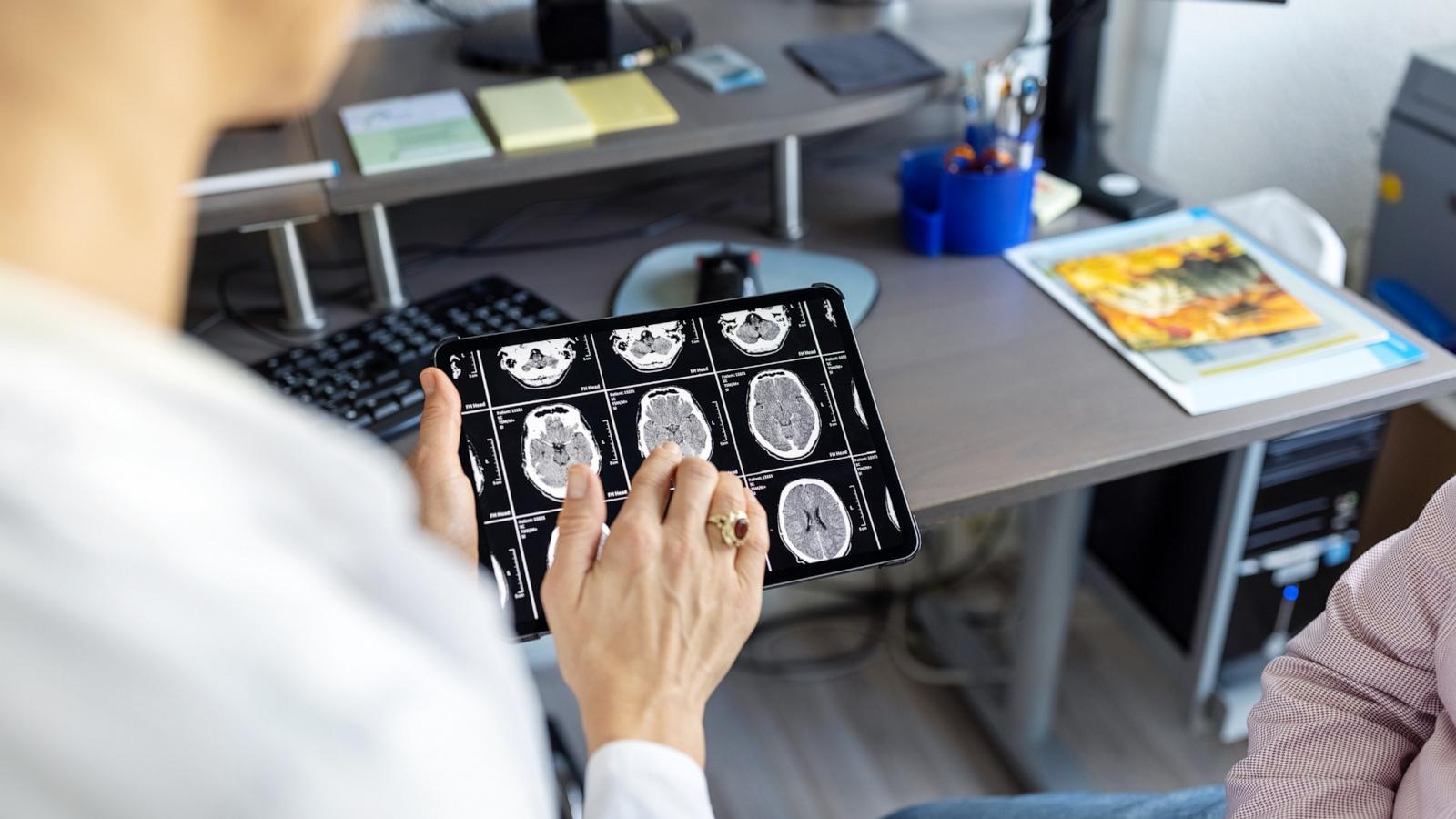 PHOTO: A doctor looks at a brain x-ray.