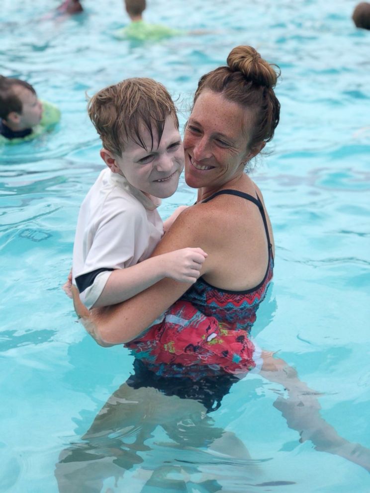 PHOTO: Charlie Sumner is held by his mother, Jamie Sumner, in a swimming pool. 