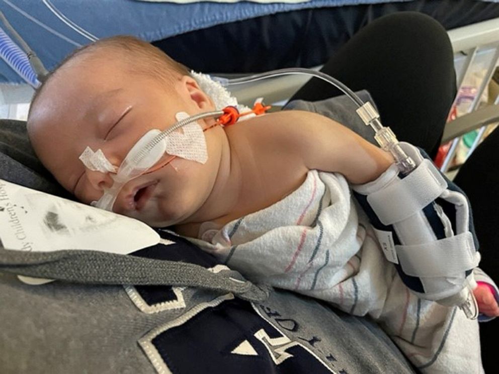 PHOTO: Charlotte, pictured here on Jan. 20, 2022, was admitted to the pediatric intensive care unit at Rady Children's Hospital the day before with breathing problems.