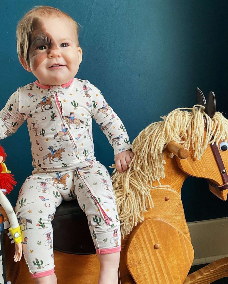 PHOTO: Winry Hall plays on a toy horse at home in an undated family photo.