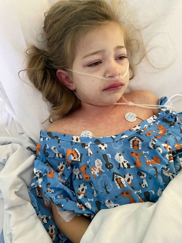 PHOTO: 
Caption: Peyton Copeland, 5, was hospitalized with Multisystem Inflammatory Syndrome in Children (MIS-C), a rare post-COVID illness.