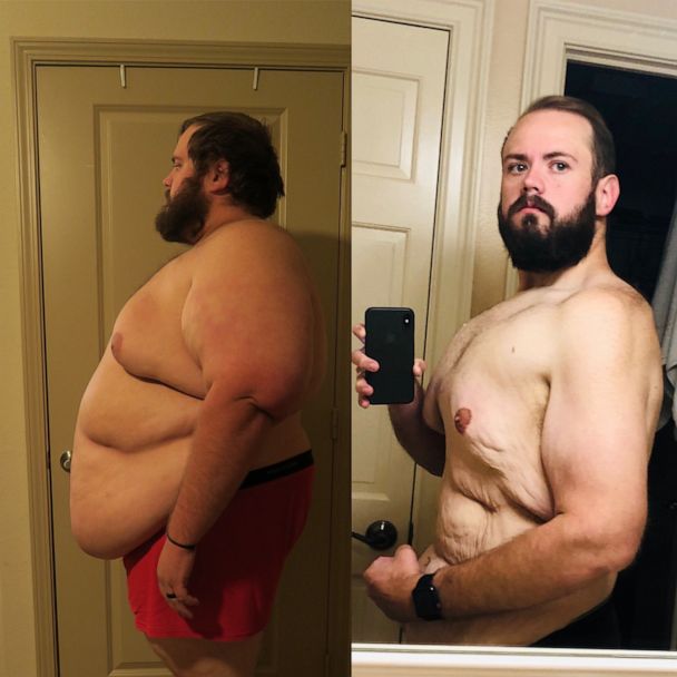 Man Loses Over 250 Pounds And Completes Marathon As Part Of Dopey Challenge Races At Disney World Gma