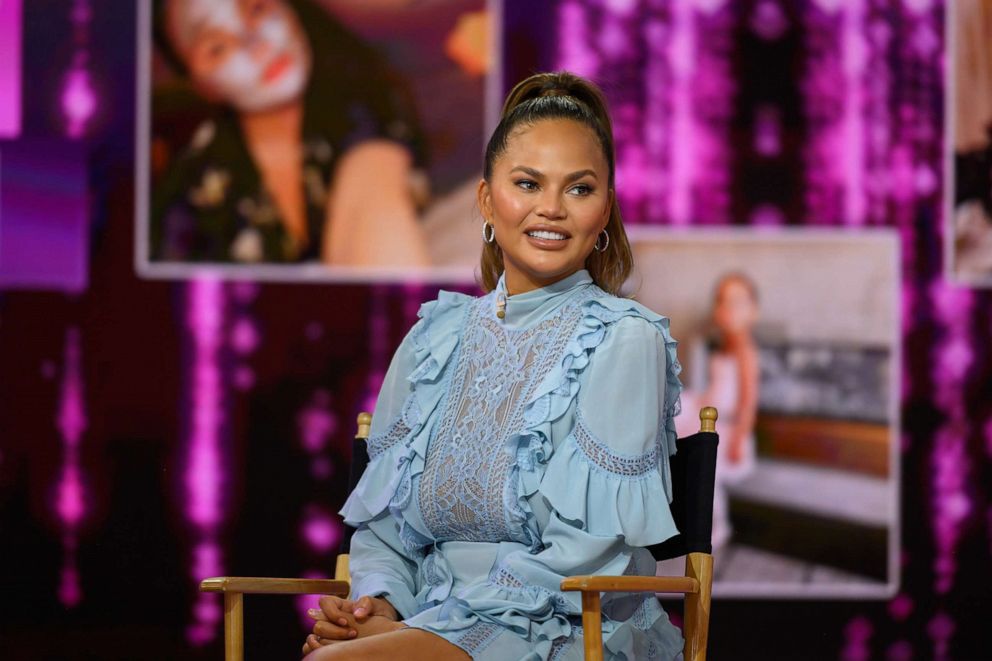 PHOTO: Chrissy Teigen appears on the Today show, Feb. 19, 2020, in New York.