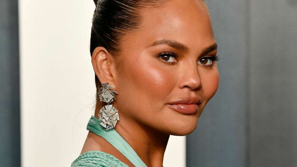 PHOTO: Chrissy Teigen attends the 2020 Vanity Fair Oscar party, Feb. 9, 2020, in Beverly Hills, Calif.