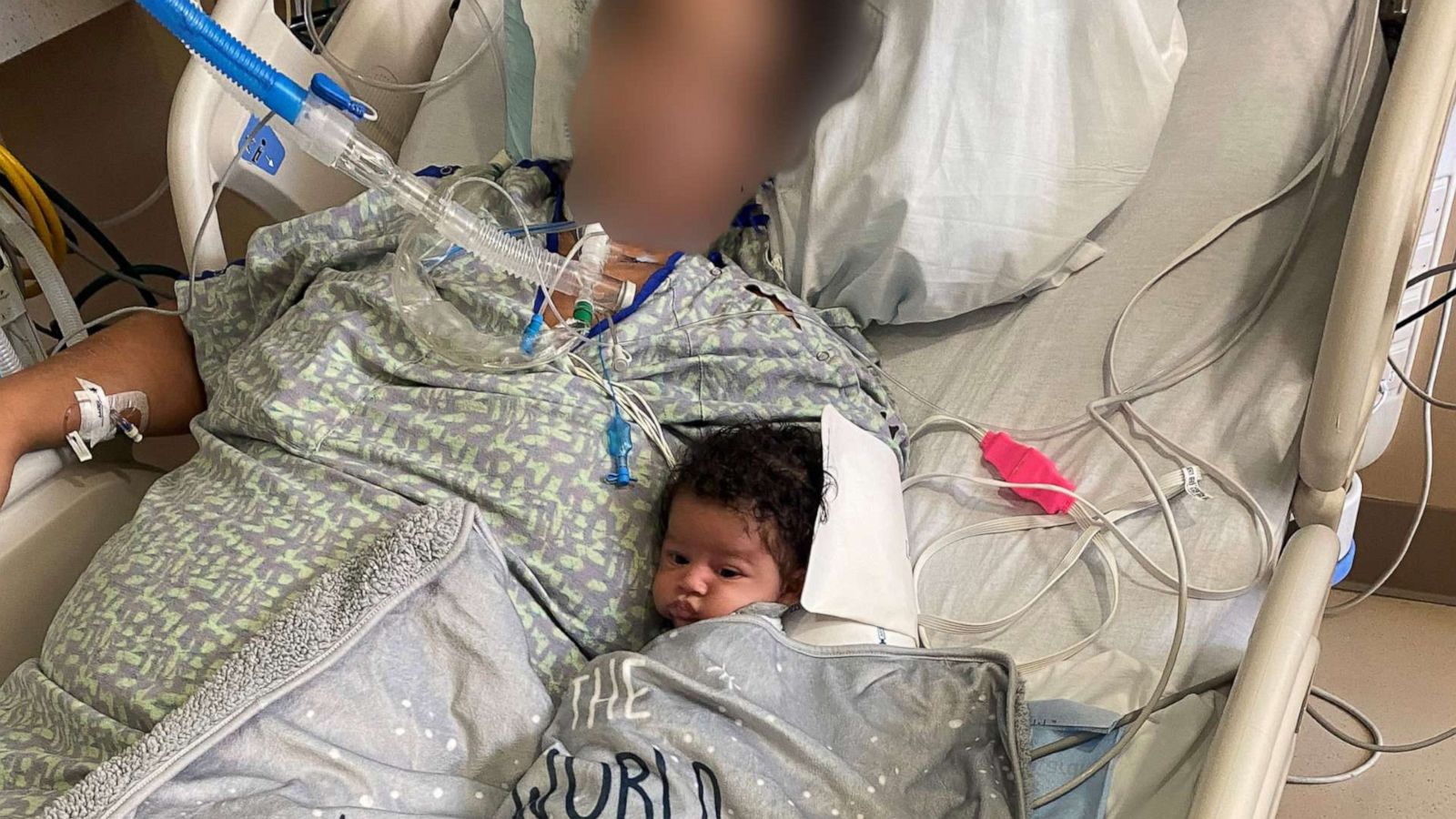 PHOTO: Cierra Chubb has been hospitalized with life-threatening COVID-19 complications since giving birth to her son, Myles, in an emergency c-section.