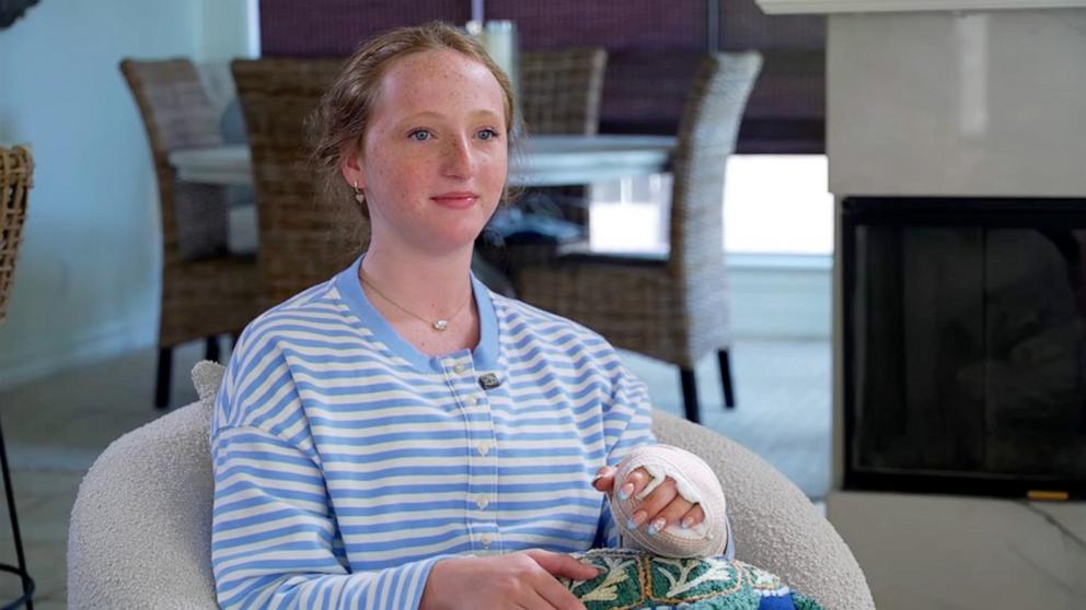 PHOTO: Claire Macdonel, 13, was vacationing with her family in the Turks and Caicos on July 19, 2026, when a barracuda bit her left hand.