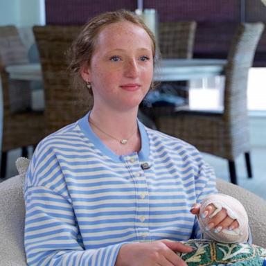 PHOTO: Claire Macdonel, 13, was vacationing with her family in the Turks and Caicos on July 19, 2026, when a barracuda bit her left hand.