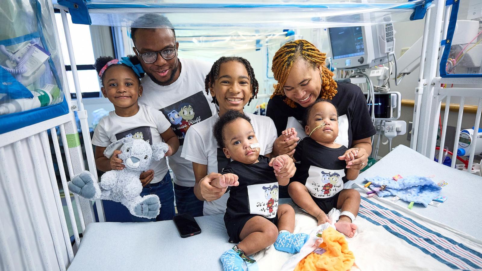 PHOTO: Twins Amari and Javar Ruffin were separated at Children’s Hospital of Philadelphia after sharing part of their sternum, diaphragm, abdominal wall and liver.