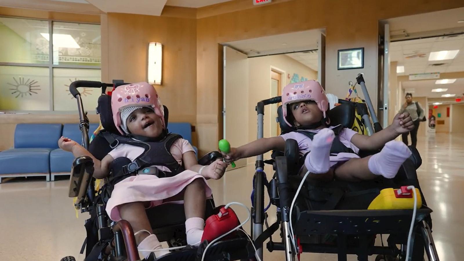 PHOTO: Hiyab and Wuhbto, two-year-old twins who were born conjoined, have undergone successful separation surgery.