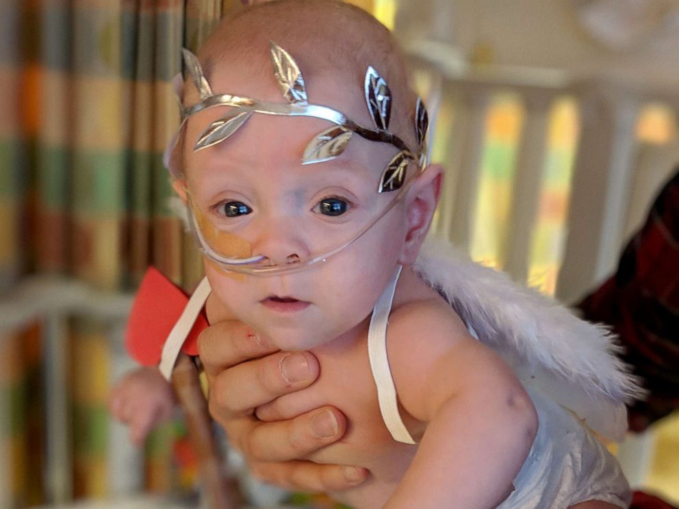 PHOTO: Eight-month-old Connor Florio of Danbury, Connecticut, a former 26-week micro preemie born less than 11 ounces in New York.