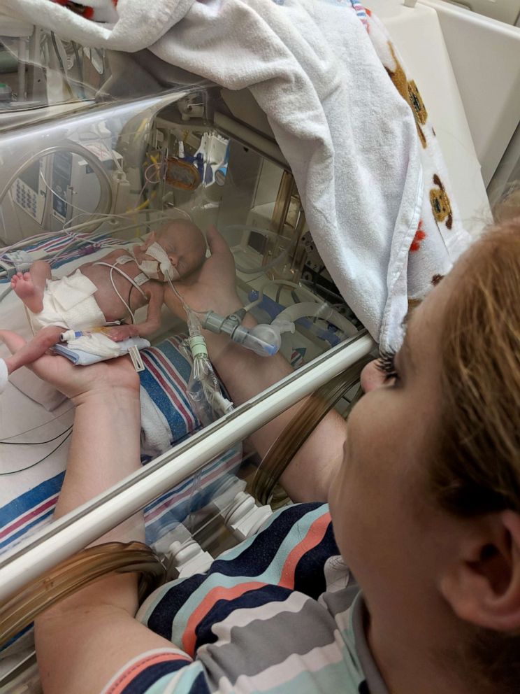 PHOTO: Connor Florio was born at 26 weeks on July 13, 2018 weighing less than 11 ounces. That's about the size of a human heart.