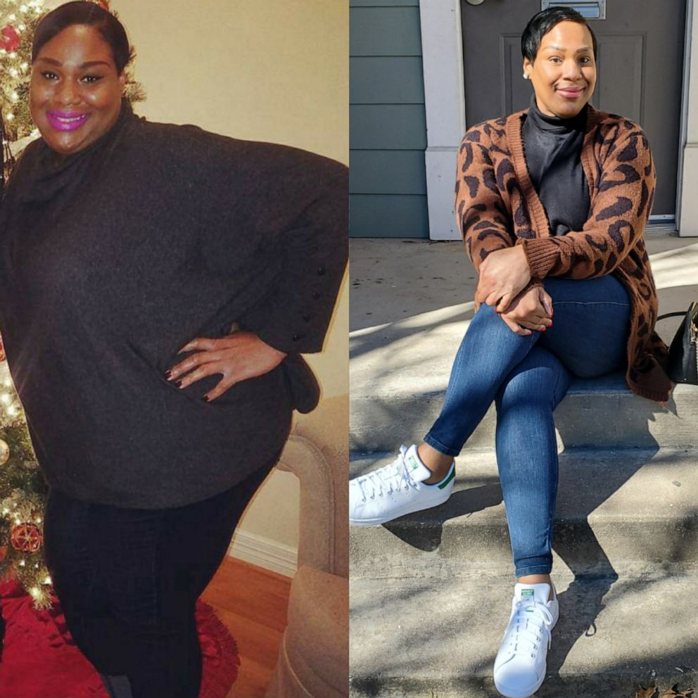 VIDEO: This woman dropped 105 pounds with the keto diet after a pre-diabetes diagnosis 