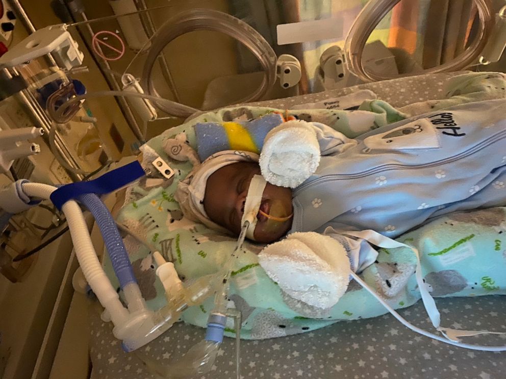 PHOTO: Curtis Means was born 132 days premature and weighed 15 ounces at birth.