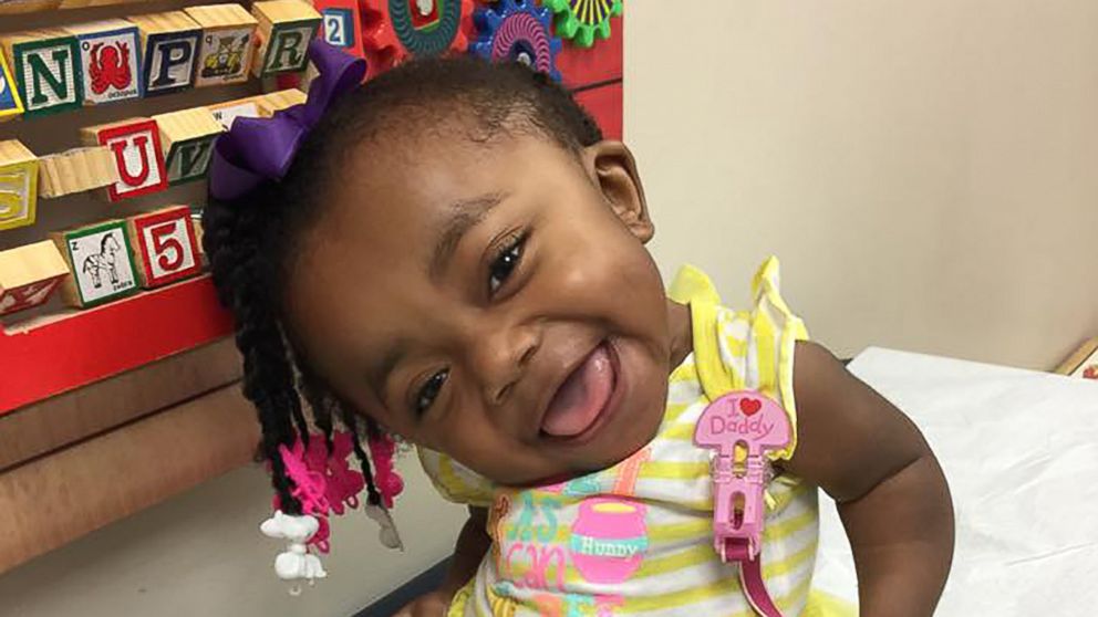 Spunky 3 year old won t let her condition stop her from spreading smiles