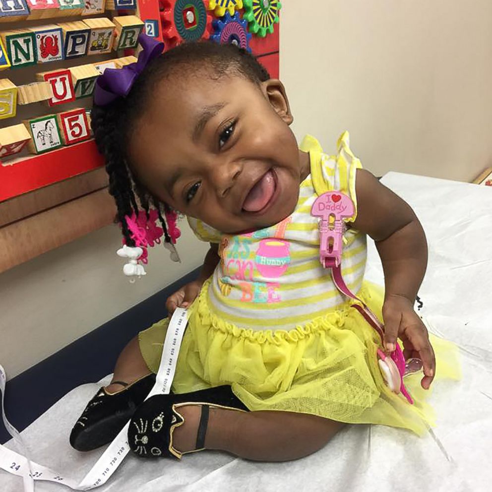 VIDEO: Spunky 3-year-old won't let her condition stop her from spreading smiles