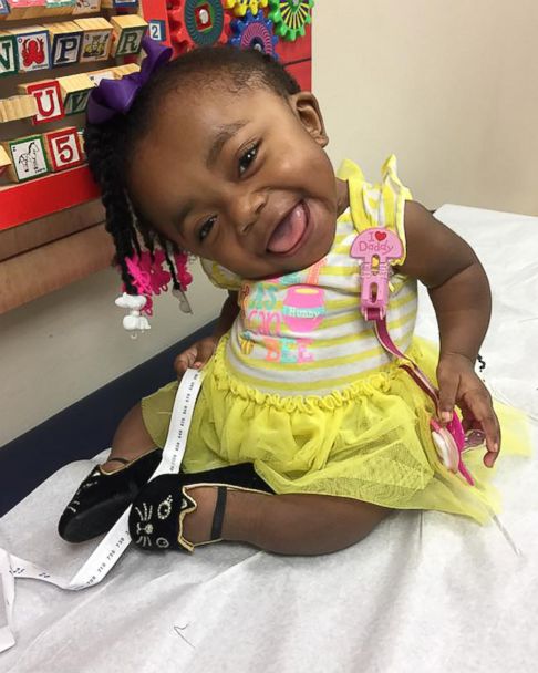 Spunky 3 year old won t let her condition stop her from spreading smiles