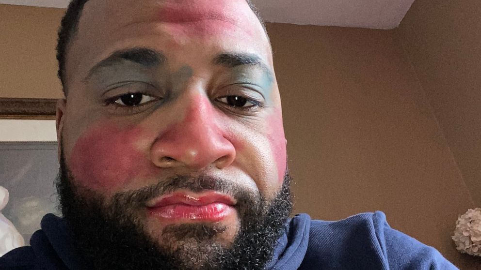 Dad goes viral after sharing daughters' makeup skills. Now, other dads are posting the same. - Vimarsana News