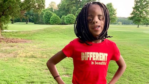 11-year-old girl teaches valuable lesson about embracing what