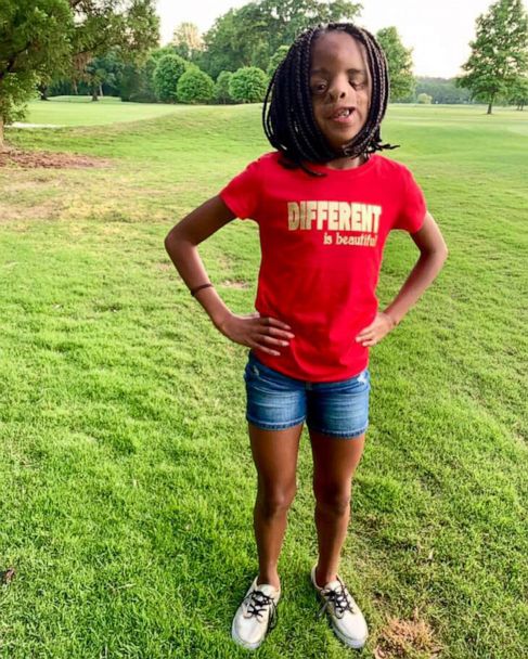 11-year-old girl teaches valuable lesson about embracing what