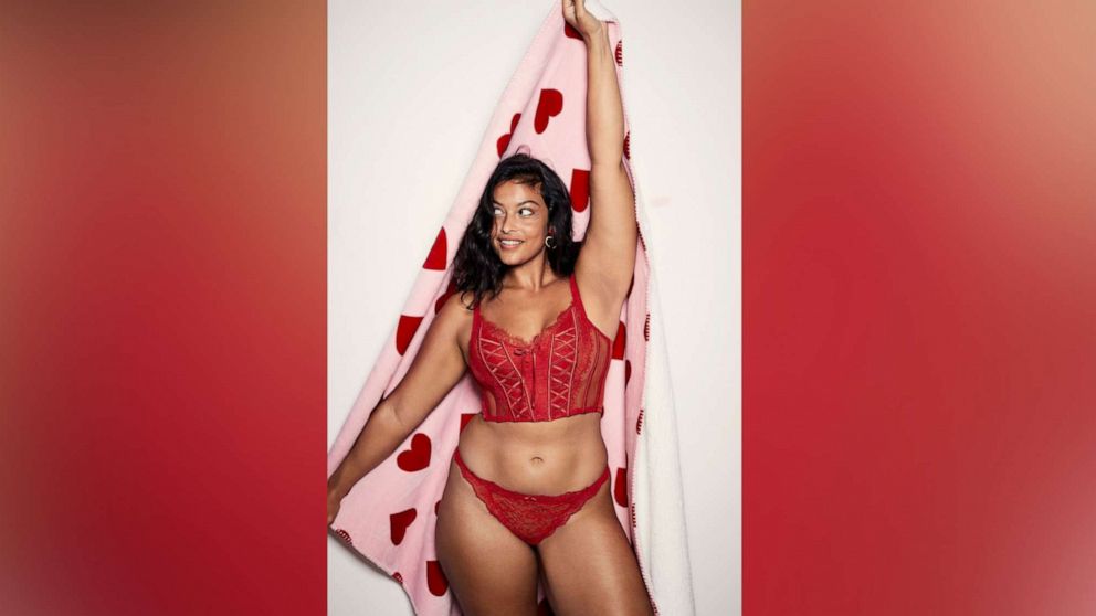 VIDEO: Meet the first model with vitiligo to walk in the Victoria's Secret fashion show