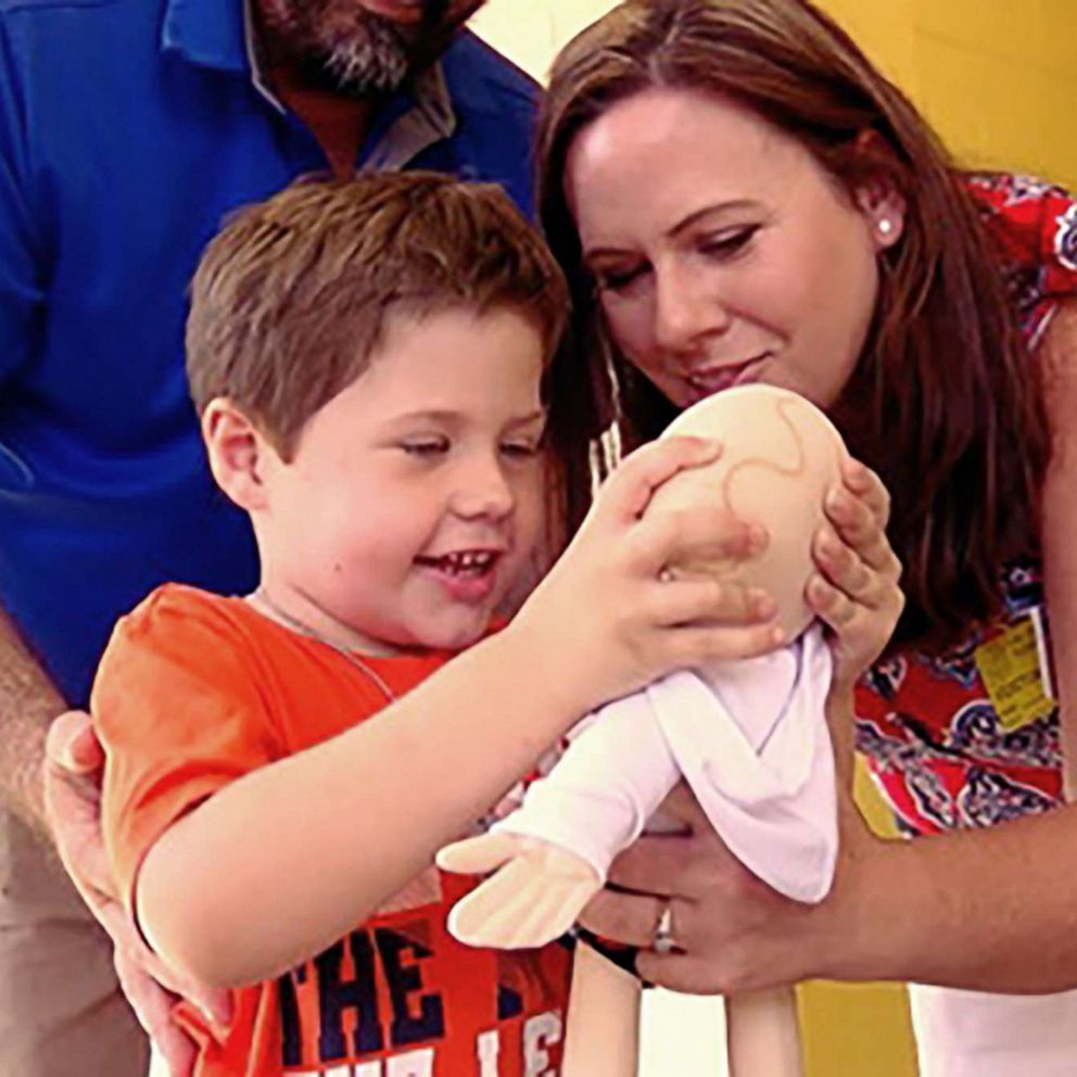 VIDEO: Students raise money to give boy with brain condition a doll with his surgery scars 