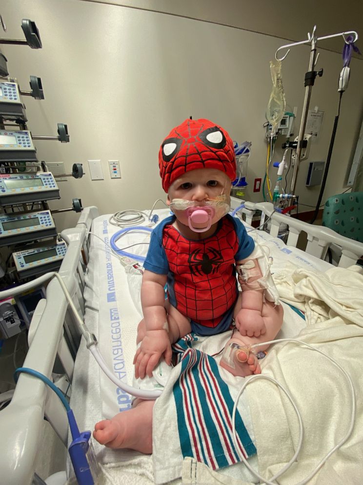 PHOTO: Elias Robinson-Rodriquez, 1, of Texas, underwent a pediatric partial heart transplant at Dell Children's Medical Center.