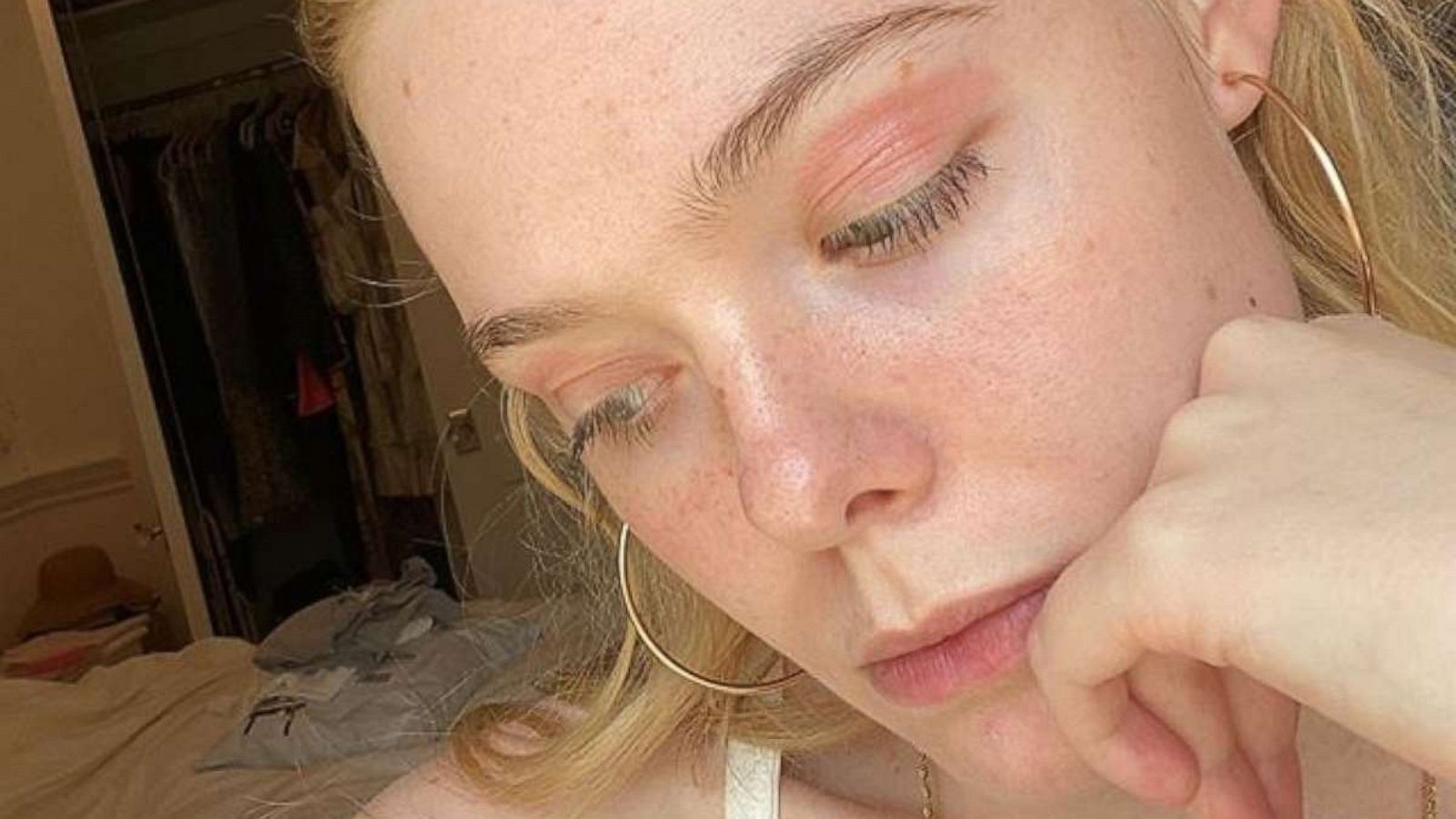 PHOTO: Elle Fanning shows she has eczema on her eyelids, as seen in a photo posted to her Instagram account.