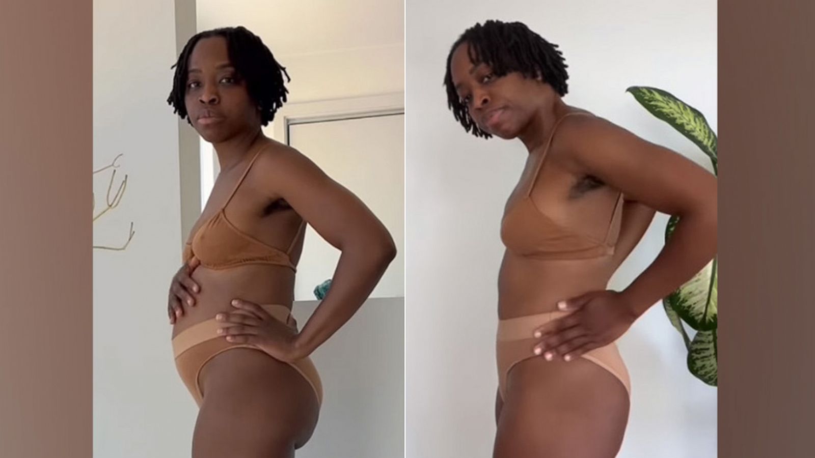 Woman has uterine fibroids removed that equaled the size of a 6-month pregnancy photo