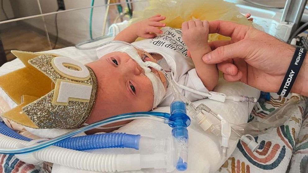 PHOTO: Lindsay and Tyler Staup, held a 100th day celebration for their daughter, Everly, at the neonatal intensive care unit at Riley Hospital for Children at IU Health in Indianapolis.