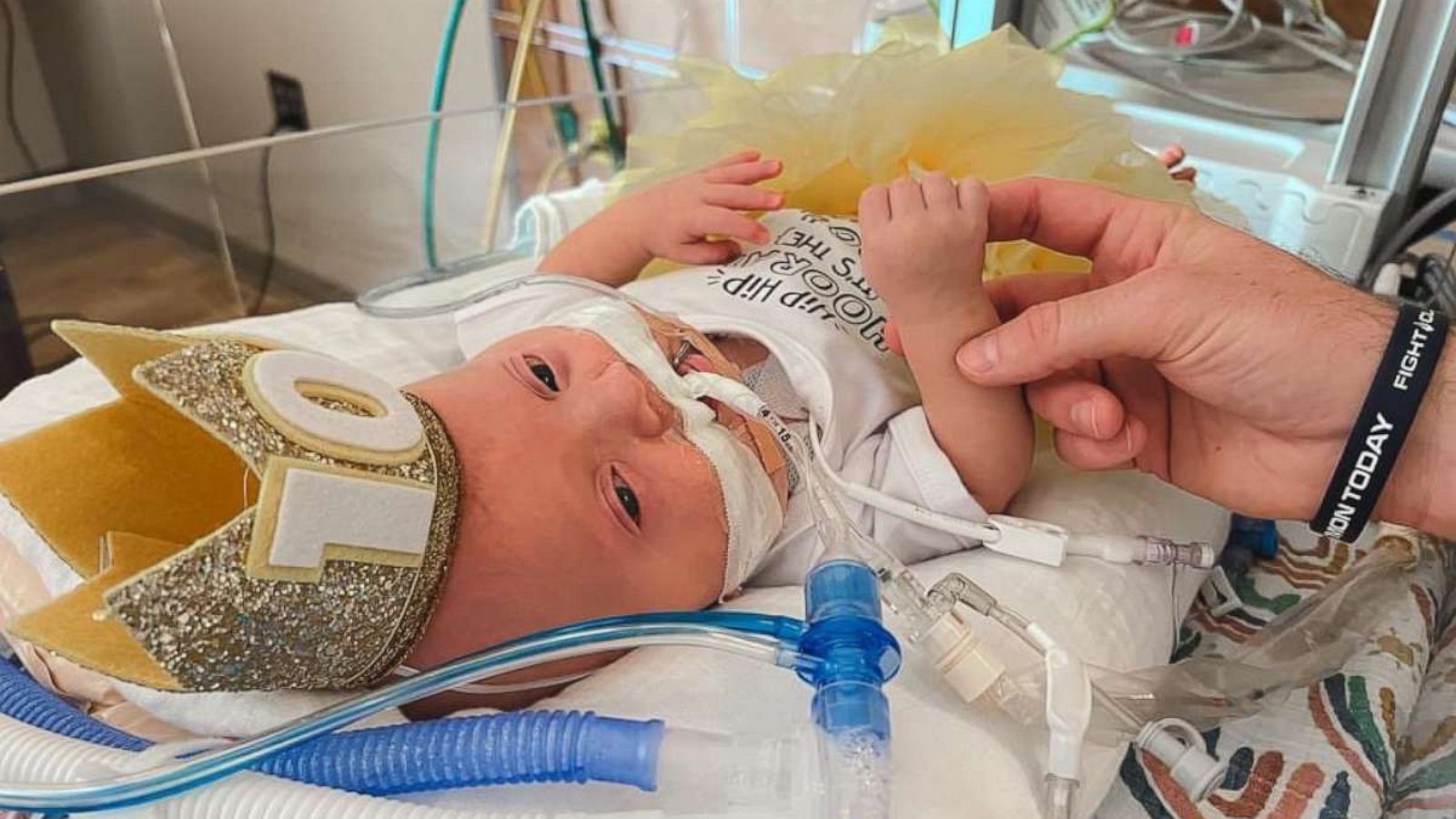 PHOTO: Lindsay and Tyler Staup, held a 100th day celebration for their daughter, Everly, at the neonatal intensive care unit at Riley Hospital for Children at IU Health in Indianapolis.